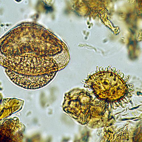 Archaeobotanical sample 